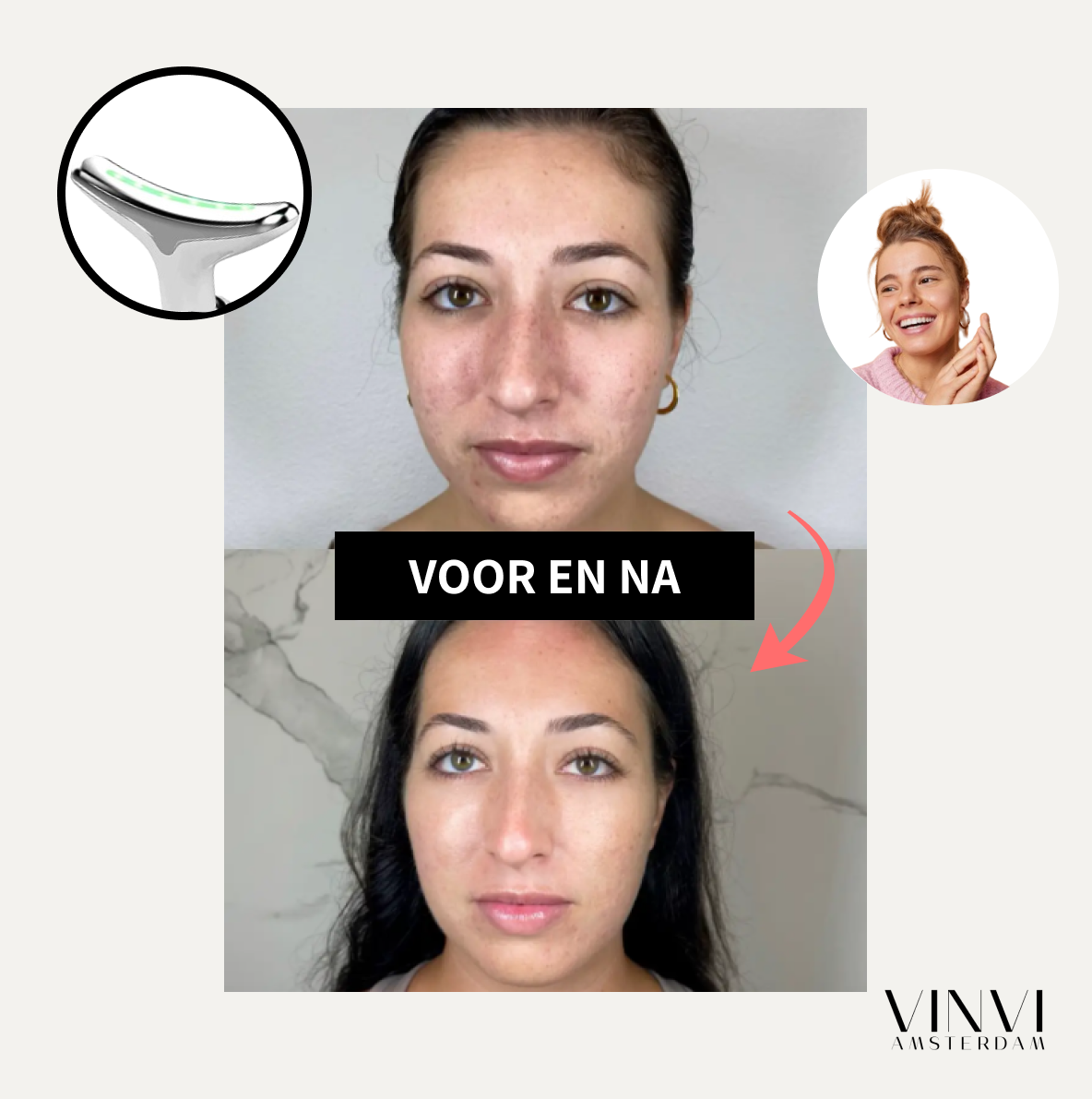 DERMALIFT™ | VERSTERK EN LIFT JE HUID MET LED-TECHNOLOGIE