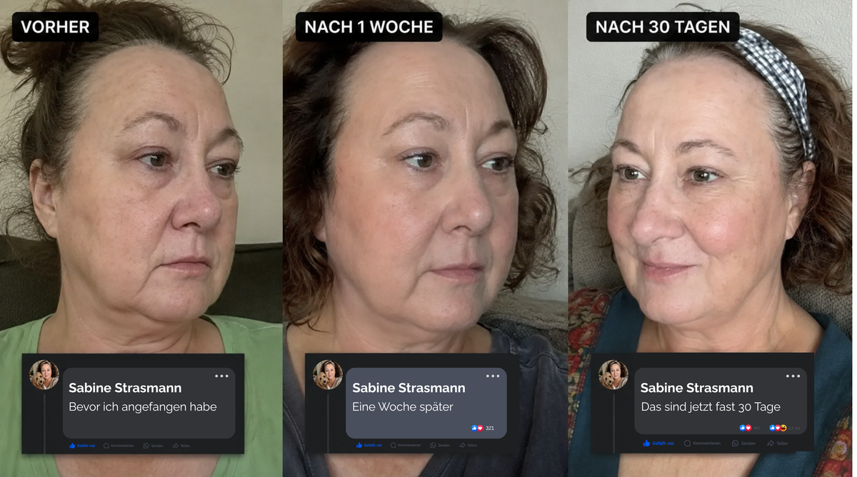 Vorher, nach einer Woche und nach 30 Tagen