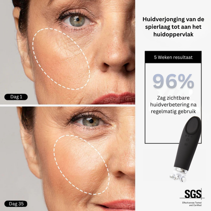 VINVI DERMAGLOW | ACTIVEER JE HUID OP EEN NATUURLIJKE MANIER VAN BINNENUIT