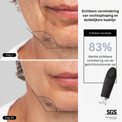 VINVI DERMAGLOW | ACTIVEER JE HUID OP EEN NATUURLIJKE MANIER VAN BINNENUIT