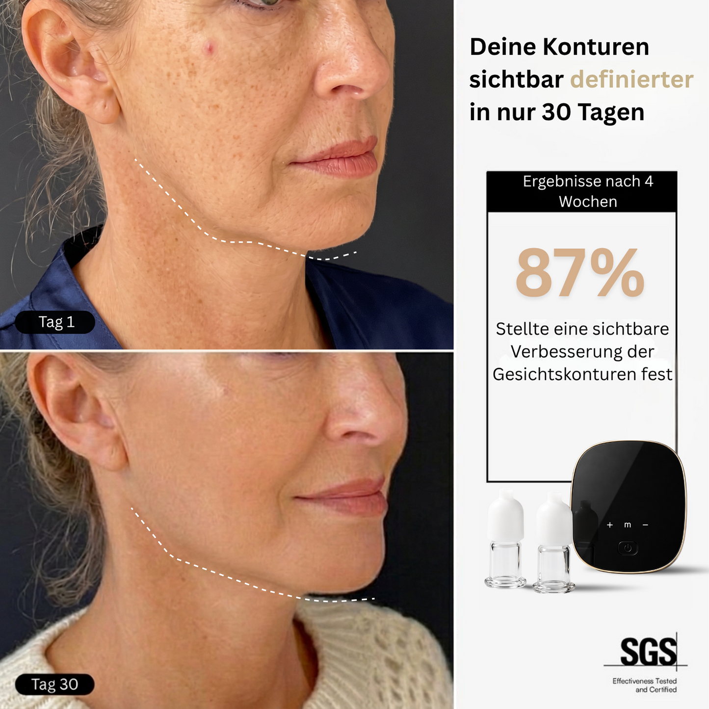 FACIAL SCULPT PRO| NATÜRLICH SICHTBAR STRAFFERE KONTUREN OHNE EINGRIFFE