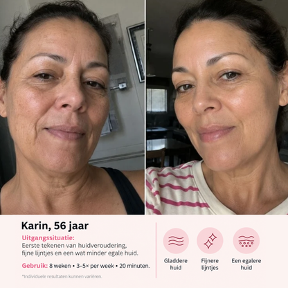 VINVI ACTIVESKIN LED MASK | EEN STEVIGERE HUID MET EEN GEZONDE GLOW
