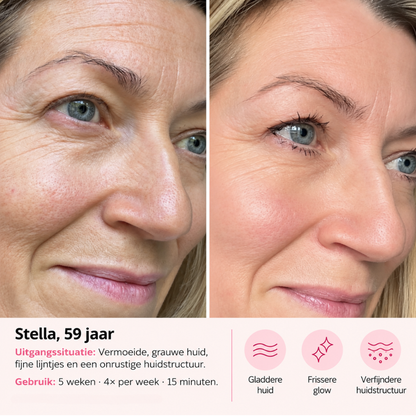 VINVI ACTIVESKIN LED MASK | EEN STEVIGERE HUID MET EEN GEZONDE GLOW