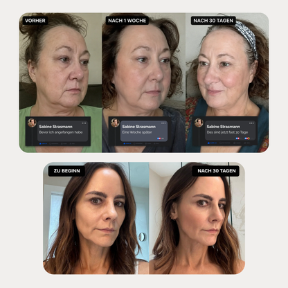 Facial Sculpt Pro